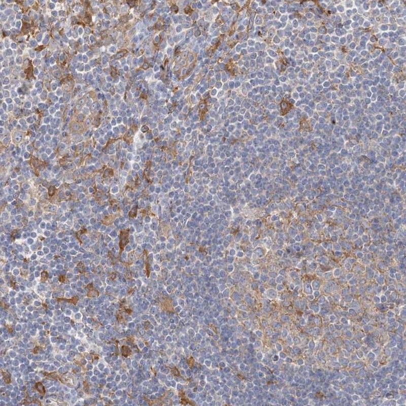 Anti-CCNJ Antibody