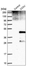 Western blot analysis in control (vector only transfected HEK293T lysate) and CCNJ over-expression lysate (Co-expressed with a C-terminal myc-DDK tag (~3.1 kDa) in mammalian HEK293T cells, LY412767).