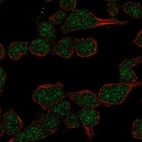 Anti-DNTT Antibody