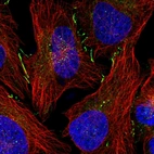 Immunofluorescent staining of human cell line U-2 OS shows positivity in cytoplasm & cell junctions.