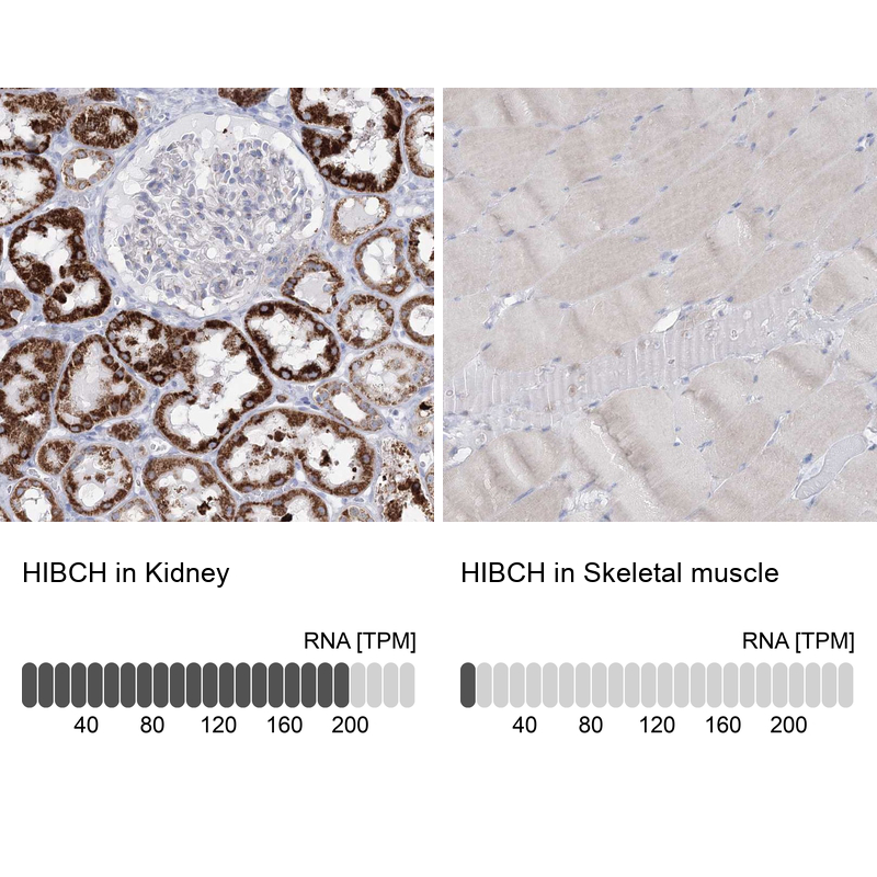 Anti-HIBCH Antibody