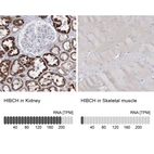 Anti-HIBCH Antibody