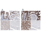 Immunohistochemical staining of human colon, kidney, liver and skeletal muscle using Anti-HIBCH antibody HPA036540 (A) shows similar protein distribution across tissues to independent antibody HPA036541 (B).