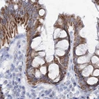 Immunohistochemical staining of human colon using Anti-HIBCH antibody HPA036540.