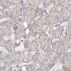Immunohistochemical staining of human liver using Anti-HIBCH antibody HPA036540.