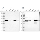 Western blot analysis using Anti-HIBCH antibody HPA036540 (A) shows similar pattern to independent antibody HPA036541 (B).