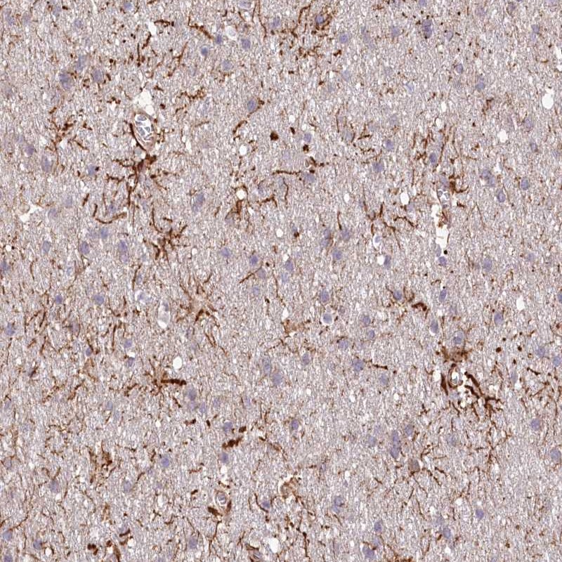 Anti-TTC1 Antibody