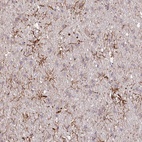 Anti-TTC1 Antibody