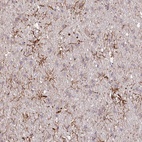 Anti-TTC1 Antibody