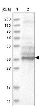 Lane 1: Marker [kDa] 230, 130, 95, 72, 56, 36, 28, 17, 11_br/_Lane 2: Human cell line RT-4