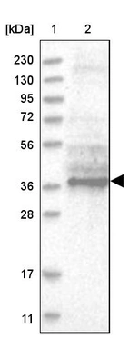 Lane 1: Marker [kDa] 230, 130, 95, 72, 56, 36, 28, 17, 11_br/_Lane 2: Human cell line RT-4