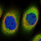 Immunofluorescent staining of human cell line A-431 shows localization to cytosol.
