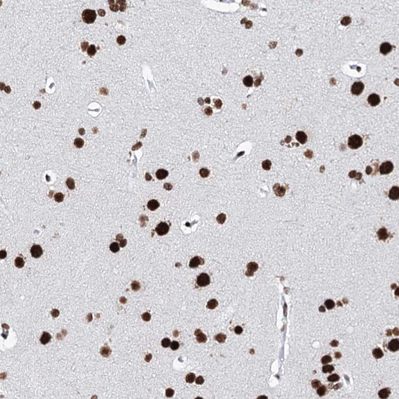 Anti-MATR3 Antibody