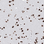 Anti-MATR3 Antibody