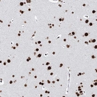 Anti-MATR3 Antibody