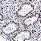 Immunohistochemical staining of human endometrium shows moderate nuclear positivity in glandular cells.