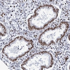 Immunohistochemical staining of human endometrium shows moderate nuclear positivity in glandular cells.