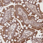 Immunohistochemical staining of human Small intestine shows moderate membranous and cytoplasmic positivity in glandular cells.