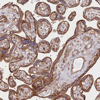Immunohistochemical staining of human Placenta shows strong membranous and cytoplasmic positivity in trophoblastic cells.