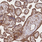 Immunohistochemical staining of human Placenta shows strong membranous and cytoplasmic positivity in trophoblastic cells.