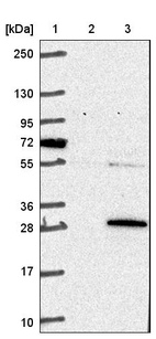 Lane 1: Marker [kDa] 250, 130, 95, 72, 55, 36, 28, 17, 10_br/_Lane 2: Negative control (vector only transfected HEK293T lysate)_br/_Lane 3: Over-expression lysate (Co-expressed with a C-terminal myc-DDK tag (~3.1 kDa) in mammalian HEK293T cells, LY415996)