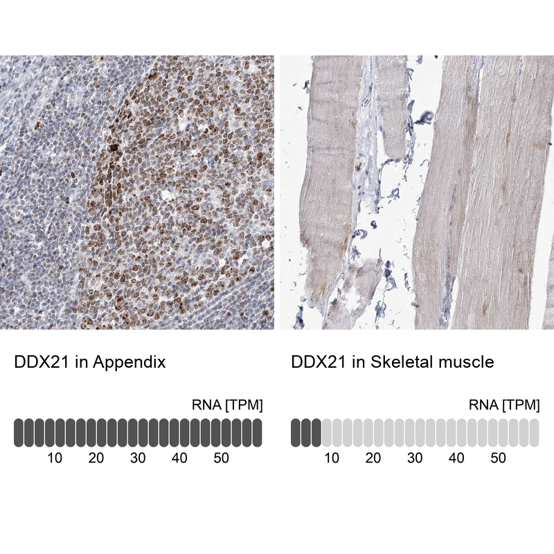 Anti-DDX21 Antibody