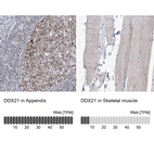 Anti-DDX21 Antibody