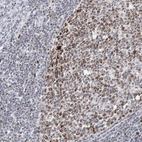 Immunohistochemical staining of human appendix shows strong positivity in nucleoli in lymphoid tissue.