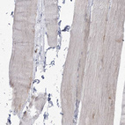 Immunohistochemical staining of human skeletal muscle shows no positivity in nucleoli in myocytes as expected.