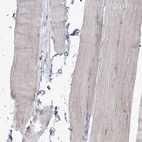 Immunohistochemical staining of human skeletal muscle shows no positivity in nucleoli in myocytes as expected.