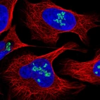 Immunofluorescent staining of human cell line U-2 OS shows localization to nucleoli.