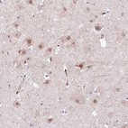 Anti-PPP2R5B Antibody