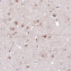 Anti-PPP2R5B Antibody