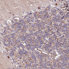 Immunohistochemical staining of human cerebellum shows moderate to strong nuclear positivity in Purkinje cells.