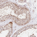 Immunohistochemical staining of human testis shows weak to moderate nuclear positivity in cells in seminiferous ducts.
