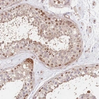Immunohistochemical staining of human testis shows weak to moderate nuclear positivity in cells in seminiferous ducts.