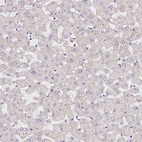 Immunohistochemical staining of human liver shows no positivity in hepatocytes as expected.