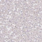Immunohistochemical staining of human liver shows no positivity in hepatocytes as expected.