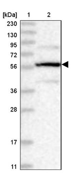 Lane 1: Marker [kDa] 230, 130, 95, 72, 56, 36, 28, 17, 11_br/_Lane 2: Human cell line RT-4