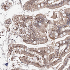 Anti-ARHGAP21 Antibody