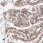Anti-ARHGAP21 Antibody