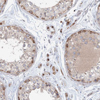 Immunohistochemical staining of human testis shows strong nuclear positivity in Leydig cells.