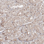 Immunohistochemical staining of human stomach shows strong nuclear positivity in glandular cells.