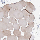 Immunohistochemical staining of human skeletal muscle shows moderate cytoplasmic positivity in myocytes.