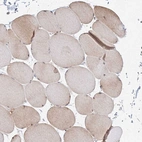Immunohistochemical staining of human skeletal muscle shows moderate cytoplasmic positivity in myocytes.