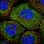 Immunofluorescent staining of human cell line A-431 shows localization to cytosol.