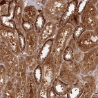 Immunohistochemical staining of human kidney shows moderate cytoplasmic positivity in cells in tubules.