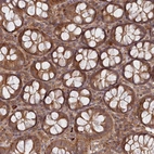 Immunohistochemical staining of human colon shows moderate cytoplasmic positivity in glandular cells.