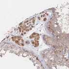 Immunohistochemical staining of human testis shows moderate cytoplasmic positivity in Leydig cells.