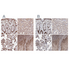 Anti-PDS5A Antibody